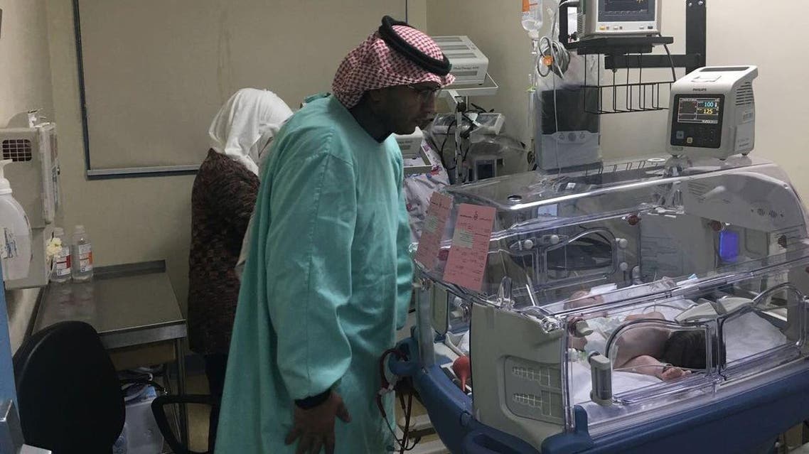 توأم سيامي من غزة سيفصل في السعودية