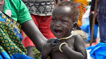 a malnourished baby cries at the feeding center for children in Jiech, Ayod County, South Sudan. (AP)