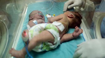 Palestinian conjoined twins airlifted to Saudi Arabia for surgical review