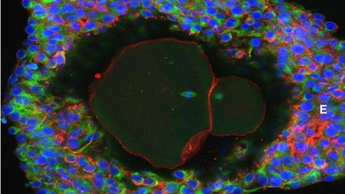 An undated picture shows a magnification of a lab-grown fully matured human egg ready for fertilization. Doctor David Albertini/University of Edinburgh/Handout via REUTERS