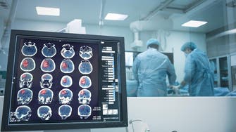 Indian surgeons remove ‘heaviest recorded’ brain tumor