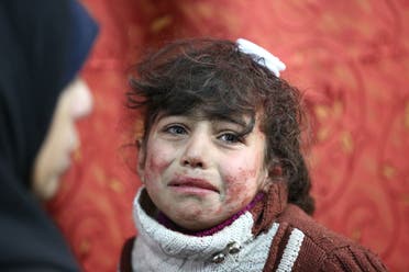 Hala, 9, receives treatment at a makeshift hospital following Syrian government bombardments in Eastern Ghouta on February 22, 2018. (AFP)