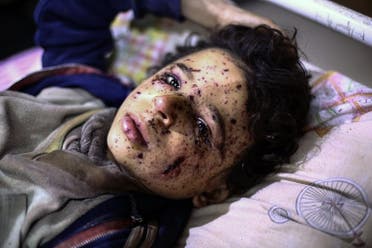 Ten-year-old Omar who was injured in an air strike, that killed several members of his family, on their home in Otaybah receives treatment at a make-shift hospital in Syria's rebel-held enclave of Eastern Ghouta, on February 25, 2018. (AFP)