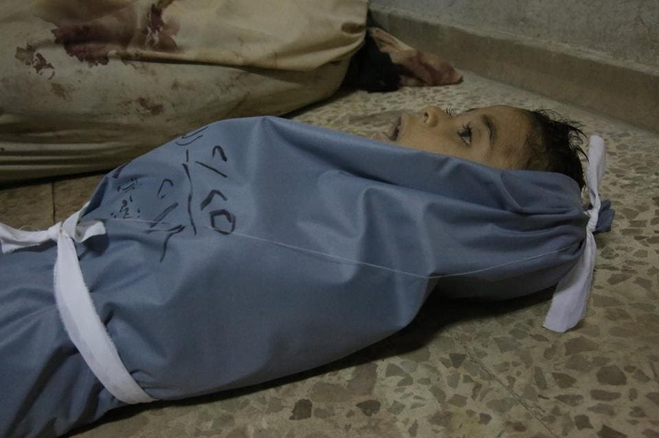 طفل قضى اختناقاً في الغوطة