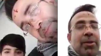 Syrian man in Germany appears on air with blood on his face after killing wife