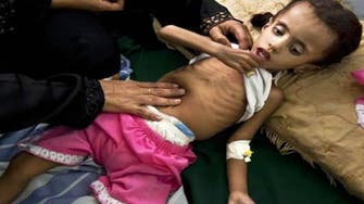 Famine puts dozens of children in Yemen on the verge of death