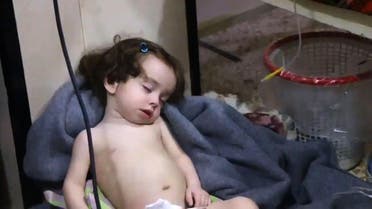 A child recovering at a hospital following an alleged chemical attack on Douma on April 8, 2018. (AFP)