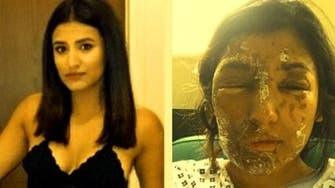 VIDEO: London man who threw acid at Muslim model jailed for 16 years