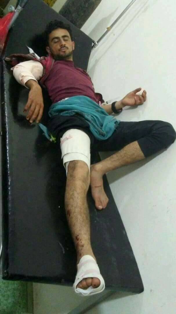 أحد ضحايا مجزرة الحوثيين في الضالع