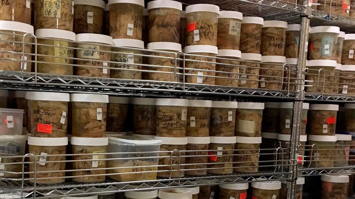 HUMAN BRAIN SAMPLES MOUNT SINAI (AP)