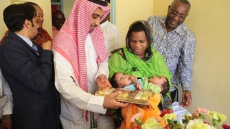 Saudi embassy finalizing arrangements to airlift Tanzanian conjoined twins
