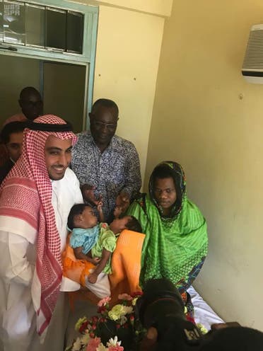 Saudi embassy finalizing arrangements to airlift Tanzanian conjoined twins