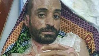 Al Arabiya English speaks to doctor treating Yemeni brutally burned by Houthis