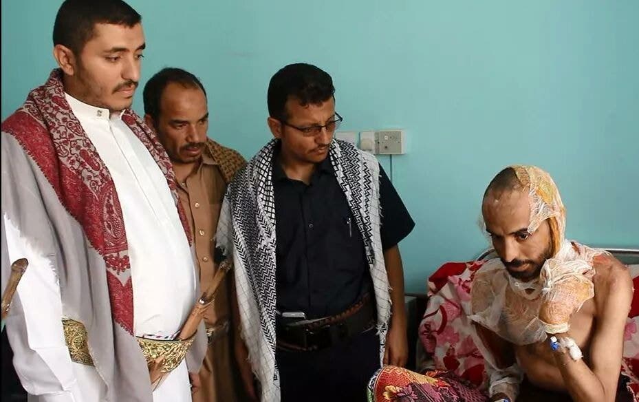 Al Arabiya English speaks to doctor treating Yemeni brutally burned by Houthis 