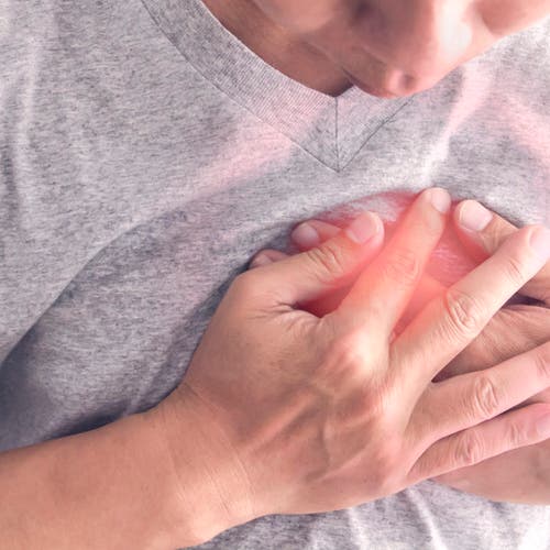 Half of heart attack patients in the UAE are aged under 50, doctors warn 