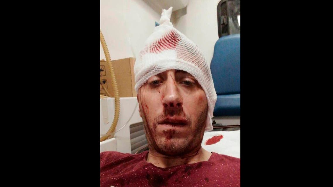 Journalist Vladimir Kovacevic is hospitalized after he was beaten in Banja Luka, Bosnia. (AP)