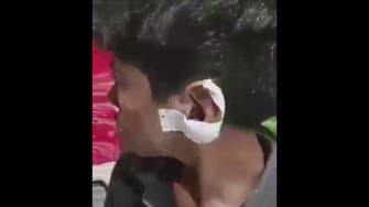 WATCH: Iranian boy tells horrific story of why a Tehran officer cut his ear 