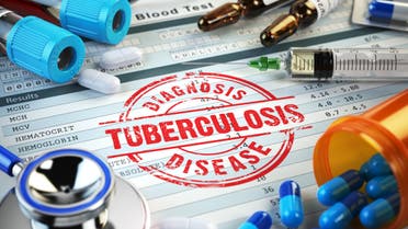 iStock السل Tuberculosis