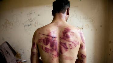 Syria torture. (AFP)