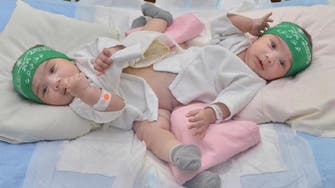 Saudi conjoined twins Sheikha and Shumukh to be separated on Thursday 