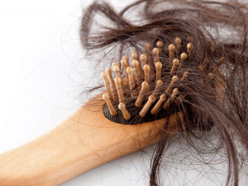 مطوي الميكروويف دمج  15 سبباً لتساقط الشعر بعضها سيثير دهشتك