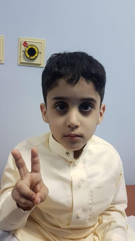 Differently abled Saudi boy hailed a hero for donating stem cells to his sister