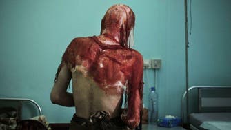 AP investigation reveals graphic torture by Houthis of Yemeni prisoners