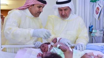 Saudi team to separate Tanzanian conjoined twins on Sunday