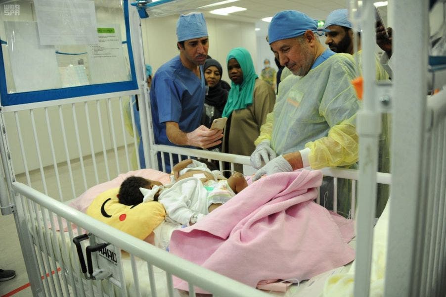 Siamese twins in Saudi. (SPA)