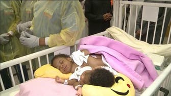 Saudi doctors successfully separate conjoined Tanzanian twins