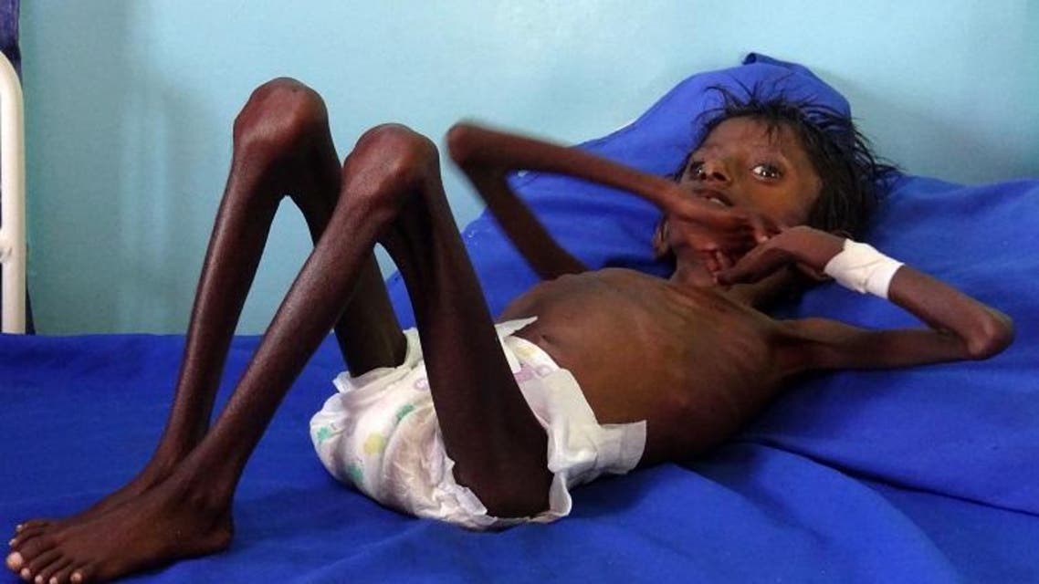 yemen famine afp