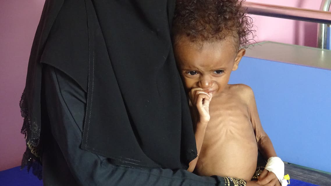 اليمن مجاعة
