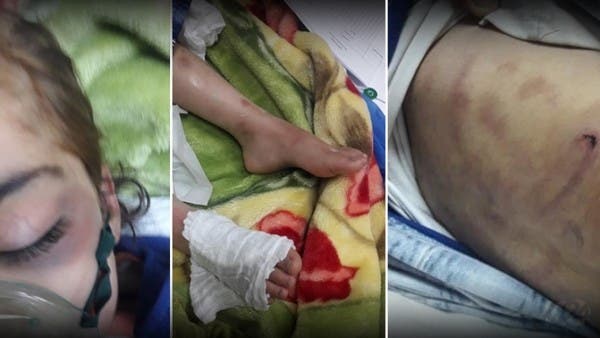 موت طفلة يهز بغداد.. حرق وصعق وكي على يد زوجة أبيها
