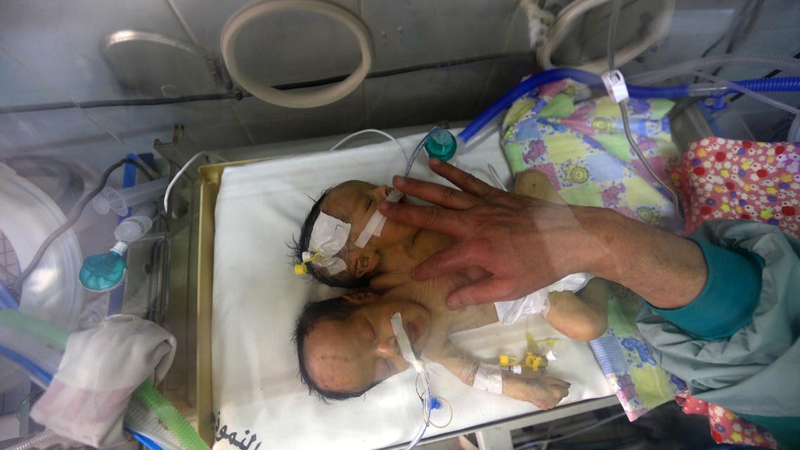 Abdelkhaleq and Abdelkarim at a hospital near Sanaa on February 6, 2019. (AFP)