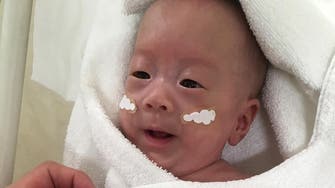 World’s smallest newborn baby leaves Tokyo hospital safely
