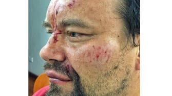 Polish reporter tells of being beaten by Venezuela police