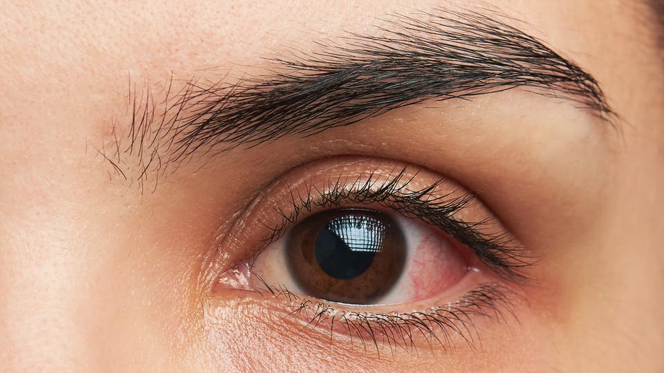 عدسات لاصقة لعلاج حساسية العين قد تطرح قريباً 6b4d7401-0a5d-438e-af8a-d550635314f0_16x9_1200x676
