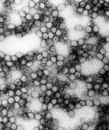 صورة مجهرية لفيروسات الحمى الصفراء التي ينقلها البعوض