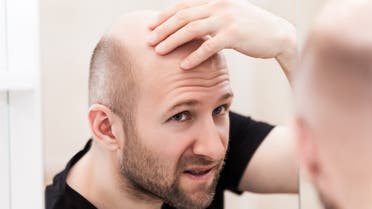Bald man looking mirror at head baldness and hair loss - Stock image