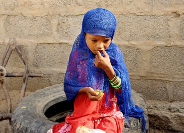 Famine in Yemen. (File photo: AP)