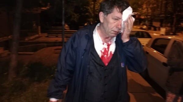 هجوم بمضارب بيسبول على صحافي معارض لأردوغان