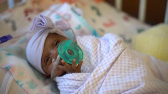 World’s tiniest surviving baby born in California