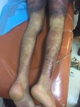 تعذيب جمال السايح