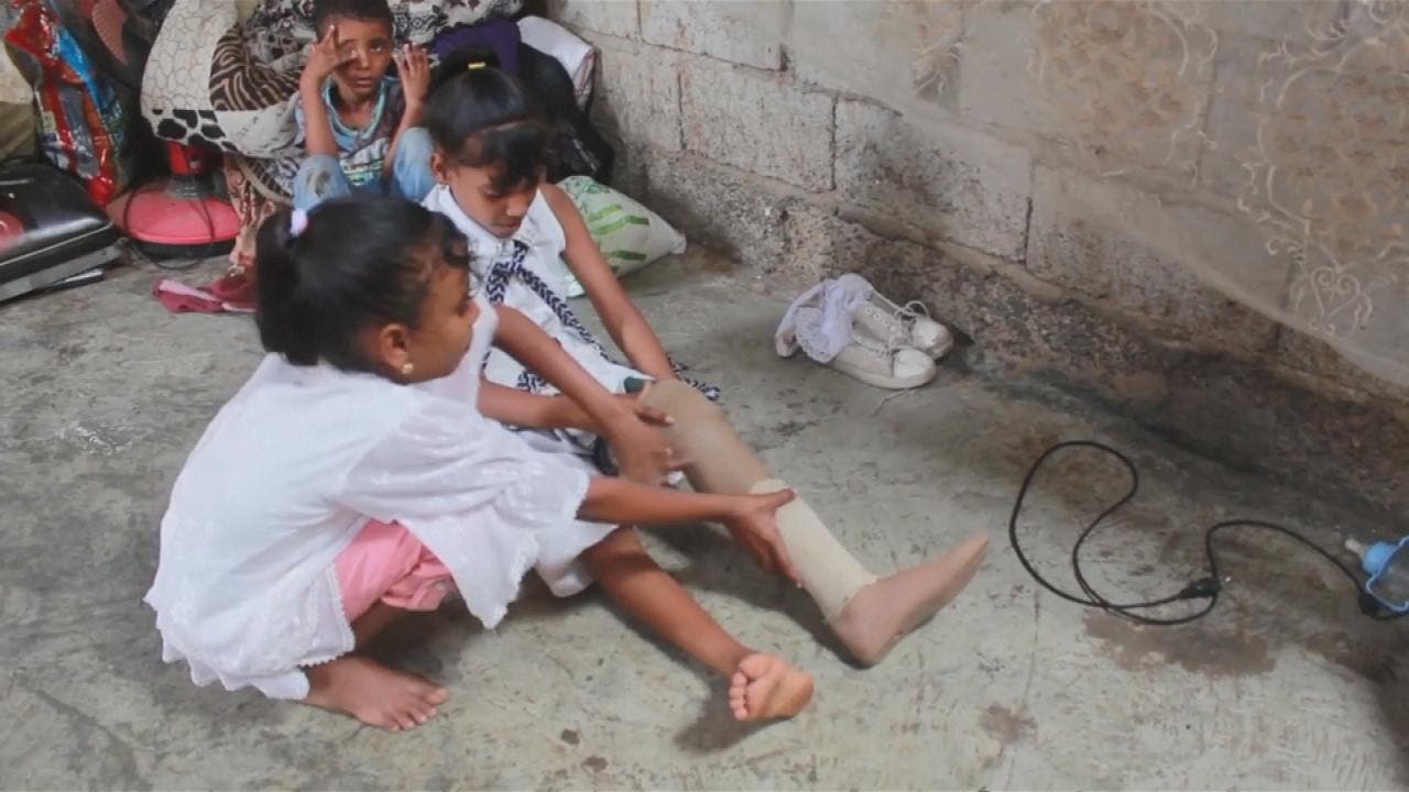 من ضحايا الألغام الحوثية 