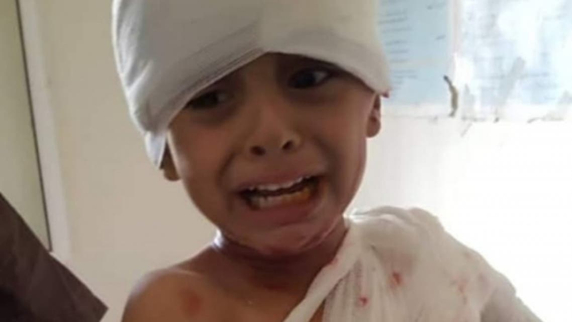 احد الاطفال المصابين جراء القصف الحوثي