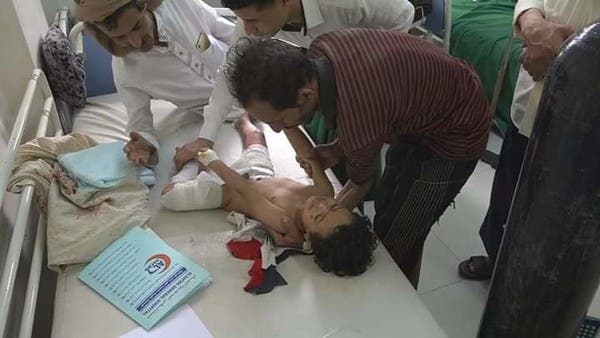 صور مؤثرة.. مجزرة حوثية جديدة ضد أطفال تعز