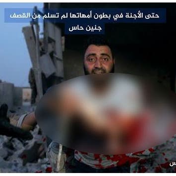 جنين يخرج من بطن أمه بعد تمزقه بقصف إدلب السورية!