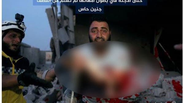 جنين يخرج من بطن أمه بعد تمزقه بقصف إدلب السورية!