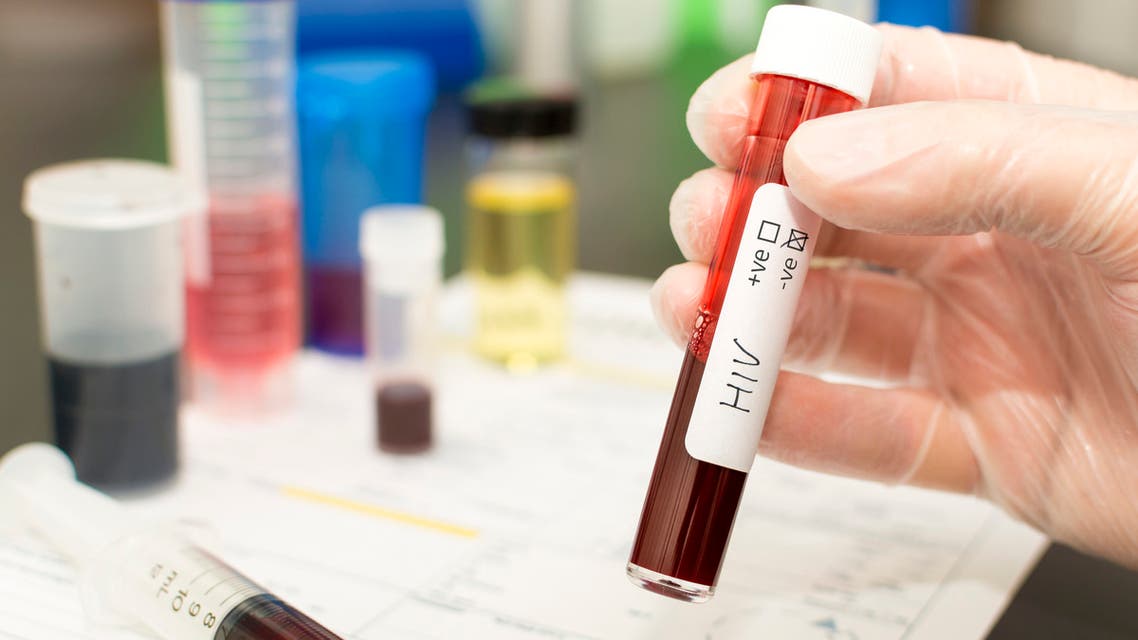 HIV - blood in a test tube stock photo