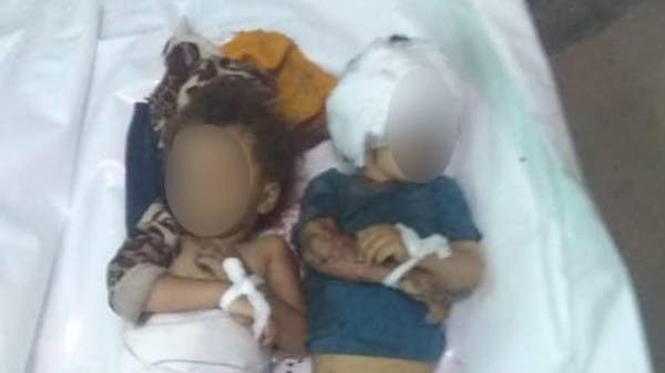صورة تفطر القلب.. مقتل طفلين جراء قصف حوثي على تعز